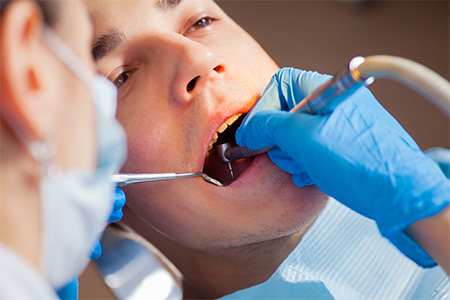 Top 7 Reasons to Schedule Your Dental Checkup Every Six Months